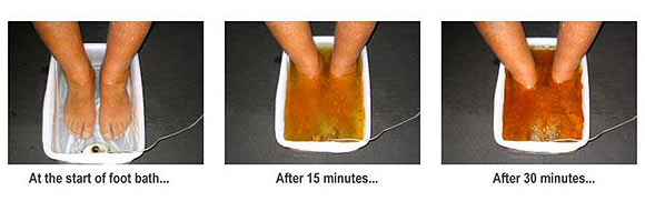 Ionic Detoxification Footbaths