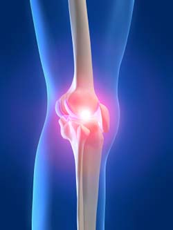 Biologic Joint Reconstruction